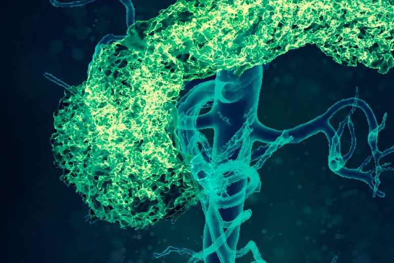 Sirds un vielmaiņas slimības