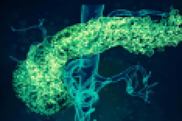 Sirds un vielmaiņas slimības